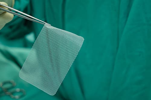 Hernia Mesh Image