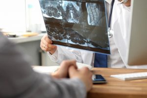 Attorneys for Internal Organ Injuries in Augusta Car Accidents
